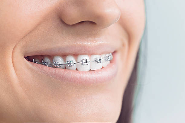 Best Wisdom Tooth Removal  in West Carrollton, OH